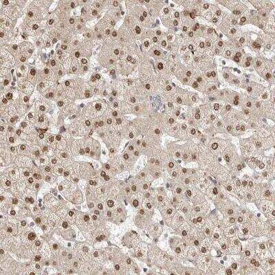 Immunohistochemistry: LCORL Antibody [NBP1-82036]