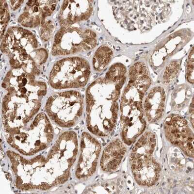 Immunohistochemistry-Paraffin: LCORL Antibody [NBP1-82036]