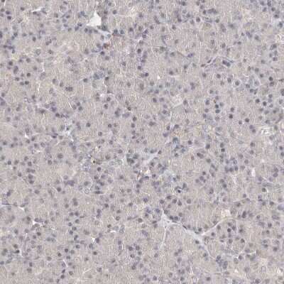 Immunohistochemistry-Paraffin: LCORL Antibody [NBP1-82036]