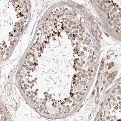 Immunohistochemistry-Paraffin: LCORL Antibody [NBP1-82036]