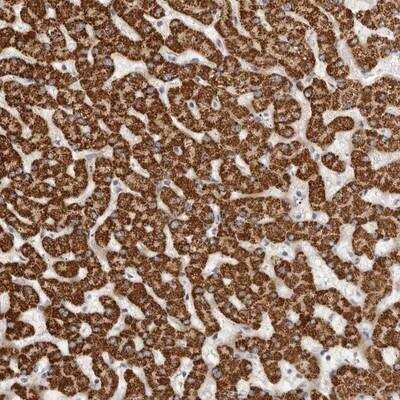 Immunohistochemistry-Paraffin: LCORL Antibody [NBP1-82037]