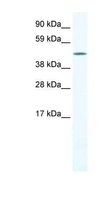 Western Blot: LCORL Antibody [NBP1-91618]