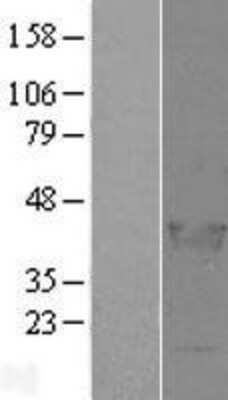 Western Blot: LCORL Overexpression Lysate [NBL1-12465]