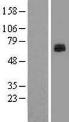 Western Blot: Lactase-like Protein/LCTL Overexpression Lysate [NBL1-12468]