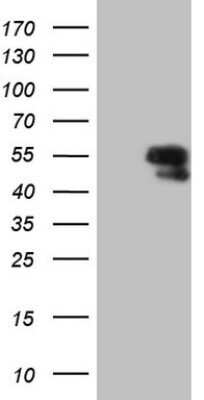 Western Blot: LCoR Antibody (OTI2F8)Azide and BSA Free [NBP2-72299]