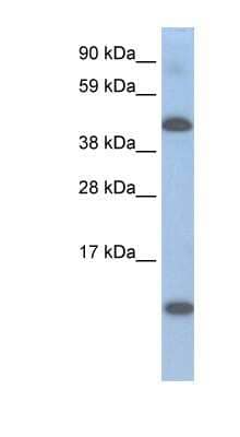 Western Blot: LCoR Antibody [NBP1-80260]