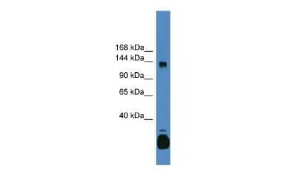 Western Blot: LCoR Antibody [NBP2-84529]