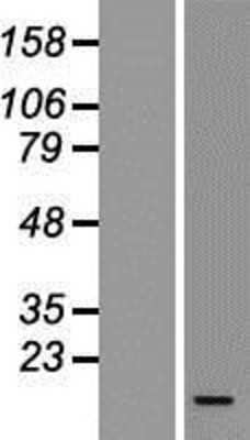 Western Blot: CCL3L1/LD78 beta Overexpression Lysate [NBL1-08857]