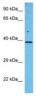 Western Blot: LDAH Antibody [NBP3-10051]