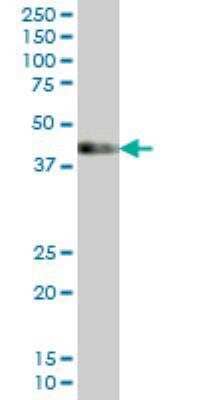 Western Blot: LDB1 Antibody (4G8) [H00008861-M03]