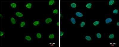 Immunocytochemistry/ Immunofluorescence: LDB1 Antibody [NBP1-31362]