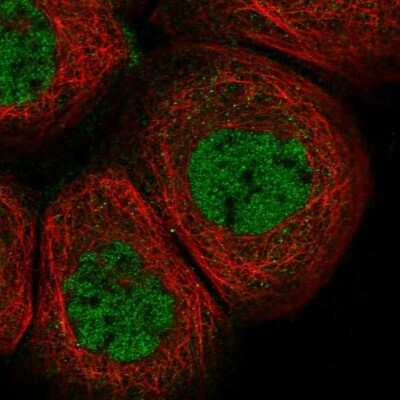 Immunocytochemistry/ Immunofluorescence: LDB1 Antibody [NBP1-85573]