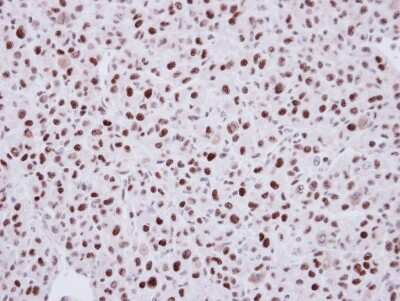 Immunohistochemistry-Paraffin: LDB1 Antibody [NBP1-31362]
