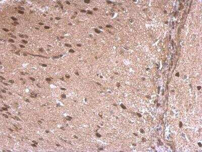 Immunohistochemistry-Paraffin: LDB1 Antibody [NBP1-31362]