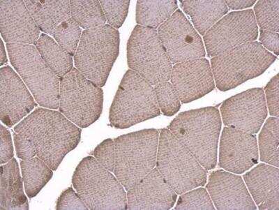 Immunohistochemistry-Paraffin: LDB1 Antibody [NBP1-31362]