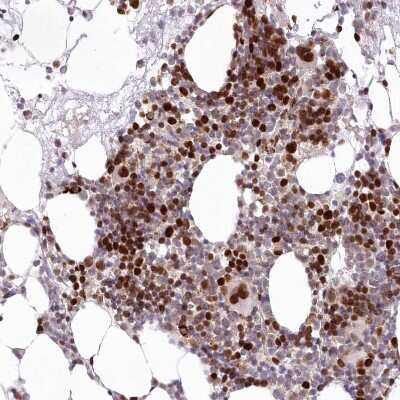 Immunohistochemistry-Paraffin: LDB1 Antibody [NBP1-85573]