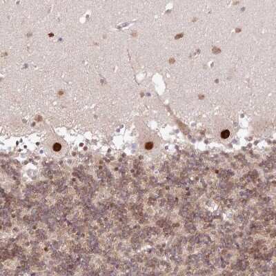 Immunohistochemistry-Paraffin: LDB1 Antibody [NBP1-85573]