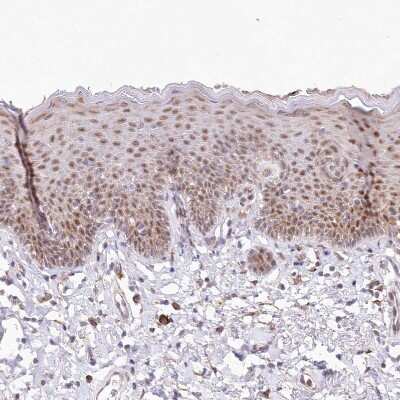 Immunohistochemistry-Paraffin: LDB1 Antibody [NBP1-85573]