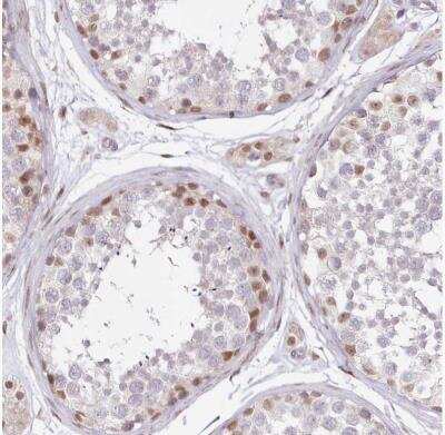 Immunohistochemistry-Paraffin: LDB1 Antibody [NBP1-85573]