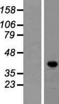 Western Blot: LDB1 Overexpression Lysate [NBP2-07940]