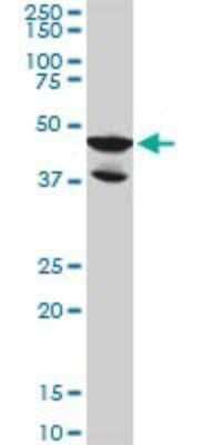 Western Blot: LDB2 Antibody (1A3) [H00009079-M02]