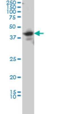 Western Blot: LDB2 Antibody (1A3) [H00009079-M02]