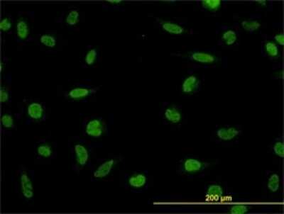 Immunocytochemistry/ Immunofluorescence: LDB2 Antibody (1C2) [H00009079-M01]
