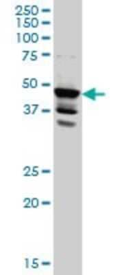 Western Blot: LDB2 Antibody (1C2) [H00009079-M01]