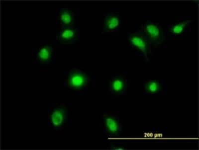 Immunocytochemistry/ Immunofluorescence: LDB2 Antibody (1C3) [H00009079-M03]