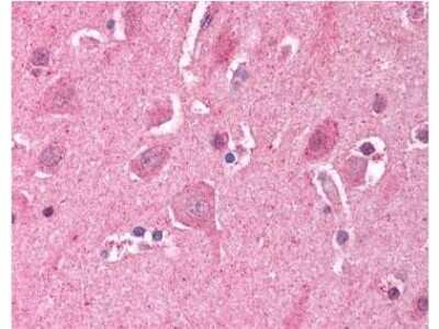 Immunohistochemistry: LDB2 Antibody [NB600-480]