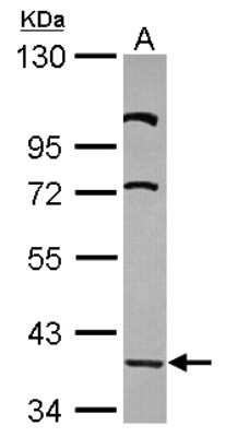 Western Blot: LDB2 Antibody [NBP2-19341]