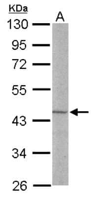 Western Blot: LDB2 Antibody [NBP2-19341]