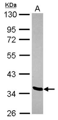 Western Blot: LDB2 Antibody [NBP2-19342]