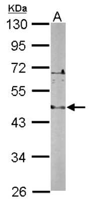 Western Blot: LDB2 Antibody [NBP2-19342]