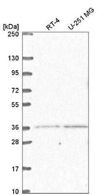 Western Blot: LDB2 Antibody [NBP2-55705]