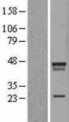 Western Blot: LDB2 Overexpression Lysate [NBL1-12469]