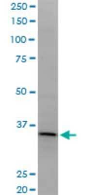 Western Blot: LDB3 Antibody (2C1) [H00011155-M04]