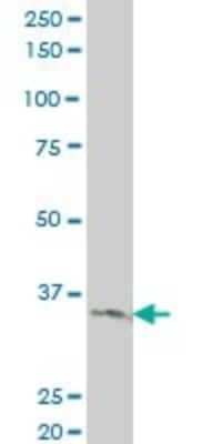 Western Blot: LDB3 Antibody (3C8) [H00011155-M06]