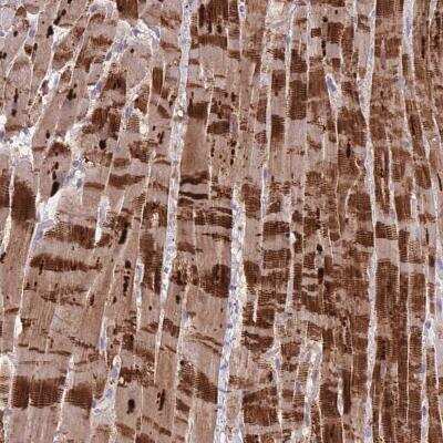 Immunohistochemistry: LDB3 Antibody [NBP2-14190]