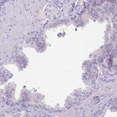 Immunohistochemistry-Paraffin: LDB3 Antibody [NBP2-14190]