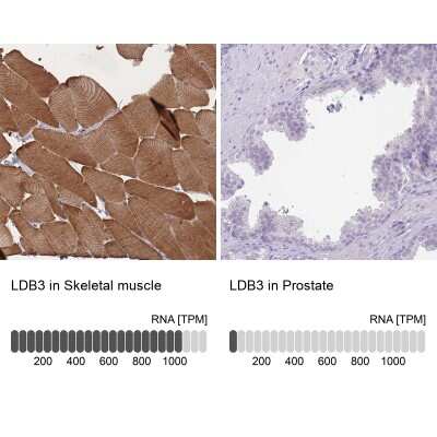 Immunohistochemistry-Paraffin: LDB3 Antibody [NBP2-14190]