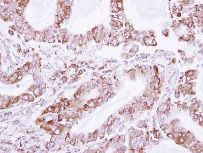 Immunohistochemistry-Paraffin: LDB3 Antibody [NBP2-19343]
