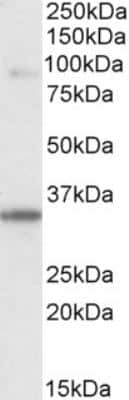 Western Blot: LDB3 Antibody [NB100-2445]