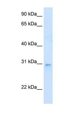 Western Blot: LDB3 Antibody [NBP1-54998]