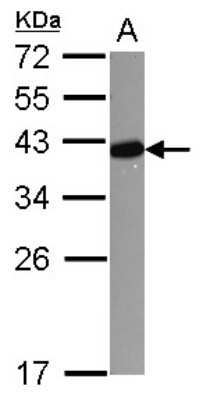 Western Blot: LDB3 Antibody [NBP2-19343]
