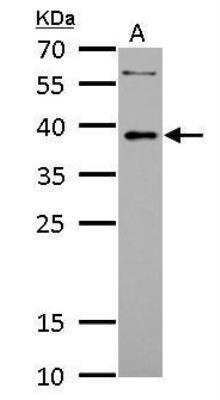 Western Blot: LDB3 Antibody [NBP2-19343]