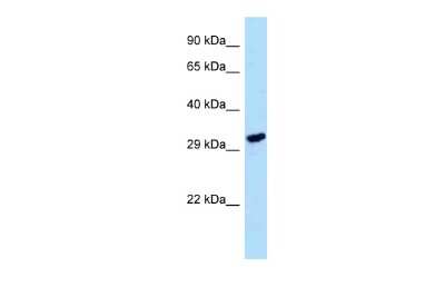 Western Blot: LDHAL6A Antibody [NBP2-84130]