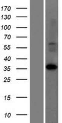 Western Blot: LDHAL6A Overexpression Lysate [NBP2-05520]