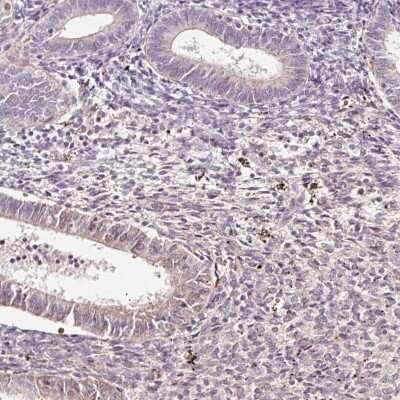 Immunohistochemistry-Paraffin: LDHAL6B Antibody [NBP2-49107]