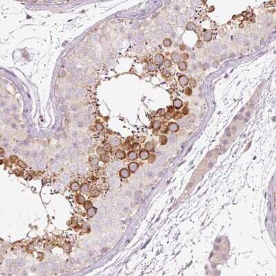 Immunohistochemistry-Paraffin: LDHAL6B Antibody [NBP2-49107]